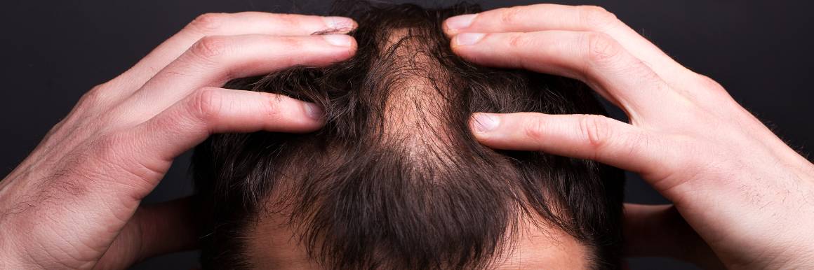 Reparerer beskadigede hårsække for sund hårvækst