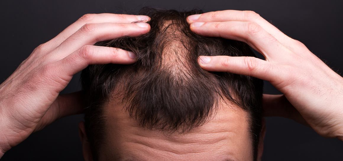 Kan CBD-olie hjælpe dit hår med at vokse?